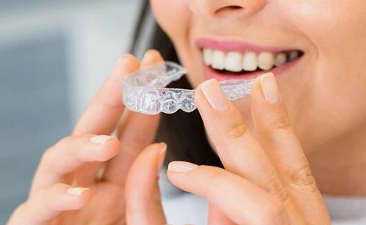 La limpieza de la férula dental paso a paso Noticia La limpieza de la férula dental paso a paso